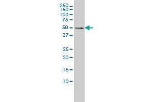 MEIS2 monoclonal antibody (M01), clone 1H4 Western Blot analysis of MEIS2 expression in HeLa . (MEIS2 Antikörper  (AA 1-381))