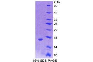 SDS-PAGE (SDS) image for Small Nuclear Ribonucleoprotein D1 Polypeptide 16kDa (SNRPD1) (AA 1-119) protein (His tag) (ABIN2126801)