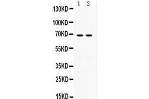 Western Blotting (WB) image for anti-Involucrin (IVL) (AA 551-585), (C-Term) antibody (ABIN3042470)