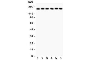 Western blot testing of PAPP-A antibody and human samples 1:  placenta;  2: HT1080;  3: SKOV;  4: 22RV1;  5: SW620;  6: MM231 lysate. (PAPPA Antikörper  (AA 95-388))