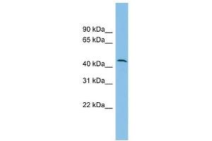 DPH1 antibody used at 1 ug/ml to detect target protein. (DPH1 Antikörper)