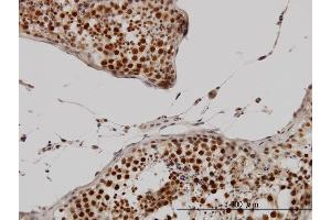 Immunoperoxidase of monoclonal antibody to CCNH on formalin-fixed paraffin-embedded human testis. (Cyclin H Antikörper  (AA 1-110))