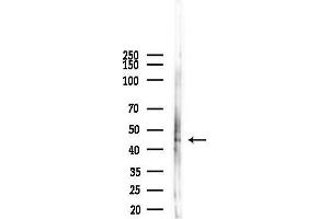 Western blot analysis of lysates from F10-LUC cells(UV,30 min treatment), using Phospho-NCF1/p47-phox (Ser345) Antibody at 1/1000 dilution.