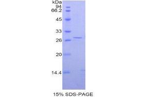 SDS-PAGE (SDS) image for Prostate Specific Antigen (PSA) (AA 25-261) protein (His tag) (ABIN1877826)