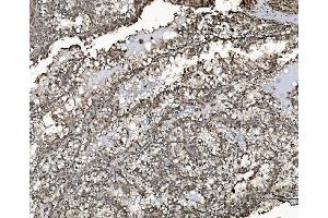 IHC analysis of REA/PHB2 using anti-REA/PHB2 antibody (ABIN7599239). (Prohibitin 2 Antikörper  (AA 1-299))