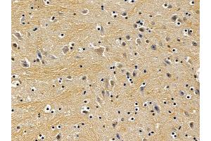 ABIN7094042 and ABIN7098086 at 1/100 staining mouse brain tissue by IHC-P.
