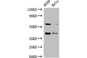 Western Blot Positive WB detected in: A549 whole cell lysate, Hela whole cell lysate All lanes: SMN1 antibody at 2 μg/mL Secondary Goat polyclonal to rabbit IgG at 1/50000 dilution Predicted band size: 32, 29, 31, 28 kDa Observed band size: 40, 60 kDa (SMN1 Antikörper  (AA 3-194))