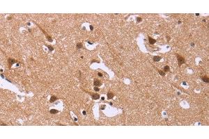 Immunohistochemistry of paraffin-embedded Human brain tissue using DCBLD2 Polyclonal Antibody at dilution 1:50 (DCBLD2 Antikörper)