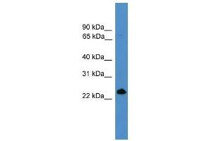 TNFSF4 antibody used at 0. (TNFSF4 Antikörper  (Middle Region))