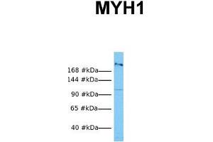 Host:  Rabbit  Target Name:  MYH1  Sample Tissue:  Human OVCAR-3  Antibody Dilution:  1. (MYH1 Antikörper  (N-Term))