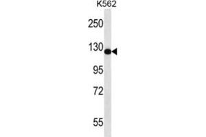 Western Blotting (WB) image for anti-RAS Protein Activator Like 2 (RASAL2) antibody (ABIN2997065) (RASAL2 Antikörper)