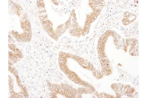 Immunohistochemistry (IHC) image for anti-Ribophorin II (RPN2) (AA 350-400) antibody (ABIN7455016) (Ribophorin II Antikörper  (AA 350-400))