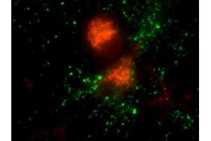 Immunocytochemistry (ICC) image for anti-Vesicle Transport through Interaction with T-SNAREs Homolog 1B (VTI1B) (AA 1-206) antibody (ABIN1742350)