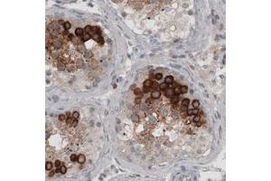 Immunohistochemical staining (Formalin-fixed paraffin-embedded sections) of human testis with LY6K monoclonal antibody, clone CL2435  shows strong cytoplasmic immunoreactivity in a subset of cells in seminiferous tubules. (Ly6k Antikörper)