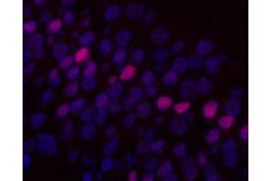 Immunofluorescence analysis of paraffin-embedded rat brain using c-Fos Monoclonal Antibody at dilution of 1:400. (c-FOS Antikörper)