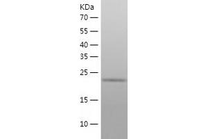 Western Blotting (WB) image for Ubiquitin-Conjugating Enzyme E2R 2 (UBE2R2) (AA 1-238) protein (His tag) (ABIN7287722) (UBE2R2 Protein (AA 1-238) (His tag))