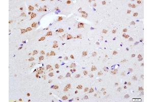 Formalin-fixed and paraffin embedded rat brain labeled with Anti-Phospho-Merlin(Ser518) Polyclonal Antibody, Unconjugated  at 1:200 followed by conjugation to the secondary antibody and DAB staining (Merlin Antikörper  (pSer518))