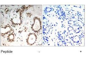 Image no. 1 for anti-Heat Shock Factor Protein 1 (HSF1) (Ser307) antibody (ABIN197434)
