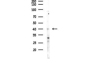 anti-Cell Division Cycle Associated 7 (CDCA7) (Internal Region) antibody