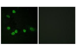 Immunofluorescence analysis of HeLa cells, using Raf1 (epitope around residue 621) antibody.