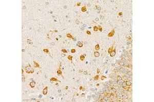 Immunohistochemistry (Paraffin-embedded Sections) (IHC (p)) image for anti-Ephrin B3 (EFNB3) antibody (ABIN7073845)