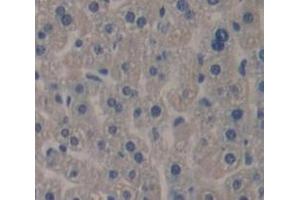 Used in DAB staining on fromalin fixed paraffin- embedded Kidney tissue (TSKU Antikörper  (AA 30-307))