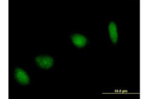 Immunofluorescence of purified MaxPab antibody to UBE2V1 on HeLa cell.