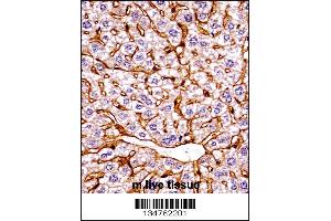 Immunohistochemistry (IHC) image for anti-Eukaryotic Translation Initiation Factor 2 alpha Kinase 4 (EIF2AK4) (AA 1477-1504), (C-Term) antibody (ABIN5531092)