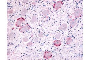Anti-TRPA1 antibody IHC of human ganglion cells. (TRPA1 Antikörper  (Internal Region))