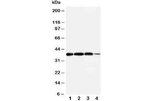 Western blot testing of Arg2 antibody and Lane 1:  rat lung;  2: (r) testis;  3: human A549;  4: (h) 293T cell lysate. (ARG2 Antikörper  (N-Term))