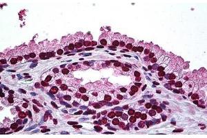 Human Prostate: Formalin-Fixed, Paraffin-Embedded (FFPE) (DLX2 Antikörper  (AA 1-110))