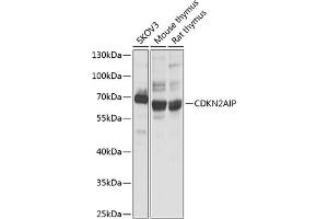 Western blot analysis of extracts of various cell lines, using CDKN2AIP antibody (ABIN1679162, ABIN3017622, ABIN3017623 and ABIN6220167) at 1:1000 dilution. (CDKN2AIP Antikörper  (AA 1-220))