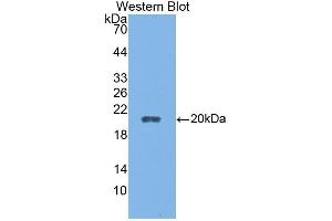 Detection of Recombinant CALY, Rat using Polyclonal Antibody to Calcyon Neuron Specific Vesicular Protein (CALY) (CALY Antikörper  (AA 110-226))