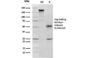 SDS-PAGE Analysis p57 Mouse Monoclonal Antibody (KIP2/880). (CDKN1C Antikörper)