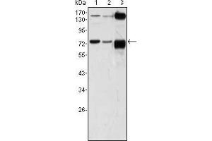 Western blot analysis using ATP2C1 mouse mAb against A431 (1), Hela (2) and HEK293 (3) cell lysate. (ATP2C1 Antikörper)