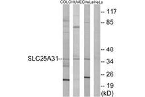 Western Blotting (WB) image for anti-Solute Carrier Family 25 (Mitochondrial Carrier, Adenine Nucleotide Translocator), Member 31 (SLC25A31) (AA 131-180) antibody (ABIN2890097) (SLC25A31 Antikörper  (AA 131-180))