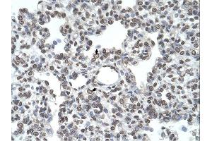 TMPRSS11D antibody was used for immunohistochemistry at a concentration of 4-8 ug/ml. (TMPRSS11D Antikörper  (Middle Region))
