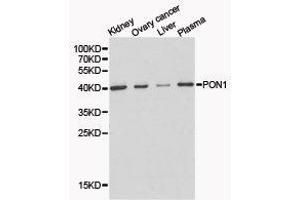 Western Blotting (WB) image for anti-Paraoxonase 1 (PON1) antibody (ABIN1874193) (PON1 Antikörper)