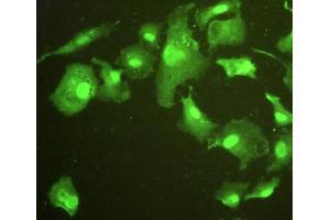 Immunohistochemistry (IHC) image for anti-Epithelial Cell Transforming Sequence 2 Oncogene (ECT2) (AA 453-647) antibody (ABIN1858683)