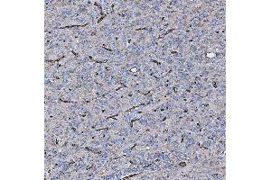 IHC analysis of PTRF/CAVIN1 using anti-PTRF/CAVIN1 antibody (ABIN7601817).