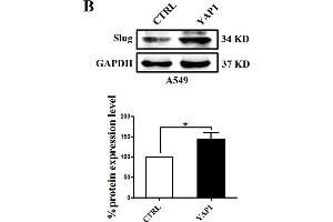 Slug is regulated by the co-transcriptional complex YAP1/TEAD in the EMT program of A549 cells. (GAPDH Antikörper)