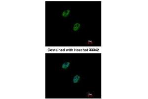 ICC/IF Image Immunofluorescence analysis of paraformaldehyde-fixed HeLa, using GABPB1, antibody at 1:500 dilution.