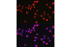 Immunofluorescence analysis of Neuro-2a cells using PRPH Rabbit pAb (ABIN1682318, ABIN3018463, ABIN3018464 and ABIN6220472) at dilution of 1:25 (40x lens). (Peripherin Antikörper  (AA 1-260))