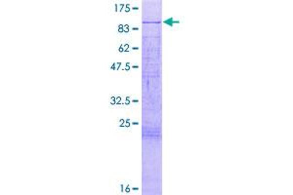 MTA2 Protein (AA 1-668) (GST tag)