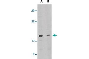Western blot analysis of IL21 expression in HL-60 cell lysate in the absence (lane A) or presence of blocking peptide (lane B) with IL21 polyclonal antibody  at 1 ug /mL . (IL-21 Antikörper  (Internal Region))
