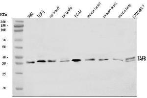 Western blot analysis of TAF8/TBN using anti-TAF8/TBN antibody (ABIN7600542).