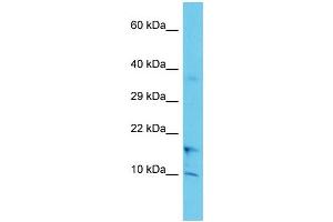 Host: Rabbit Target Name: COA1 Sample Type: Jurkat Whole Cell lysates Antibody Dilution: 1.