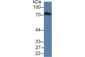 Western Blot; Sample: Human Serum; Primary Ab: 1µg/ml Rabbit Anti-Human JPH1 Antibody Second Ab: 0. (Junctophilin 1 Antikörper  (AA 1-201))