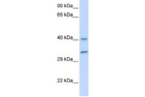 Western Blotting (WB) image for anti-AlkB, Alkylation Repair Homolog 3 (ALKBH3) antibody (ABIN2459903) (ALKBH3 Antikörper)