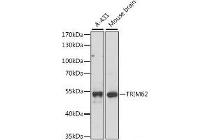 Western blot analysis of extracts of various cell lines using TRIM62 Polyclonal Antibody at dilution of 1:1000. (TRIM62 Antikörper)